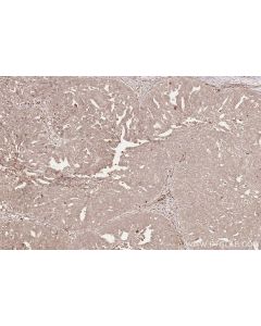 IHC easy ® WDR81 Ready-To-Use IHC Kit KHC2537 proteintech