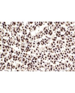 IHC easy ® ZC3H13 Ready-To-Use IHC Kit KHC2550 proteintech