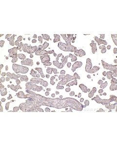IHC easy ® UBR4 Ready-To-Use IHC Kit KHC2554 proteintech