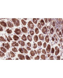 IHC easy ® VPS53 Ready-To-Use IHC Kit KHC2560 proteintech