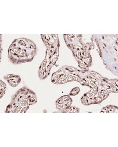 IHC easy ® ZC3H14 Ready-To-Use IHC Kit KHC2593 proteintech