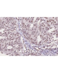 IHC easy ® USP37 Ready-To-Use IHC Kit KHC2631 proteintech