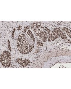 IHC easy ® ZC3H18 Ready-To-Use IHC Kit KHC2692 proteintech