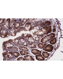 IHC easy ® WDR48 Ready-To-Use IHC Kit KHC2705 proteintech