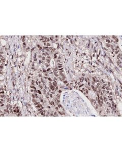IHC easy ® UBA3 Ready-To-Use IHC Kit KHC2708 proteintech