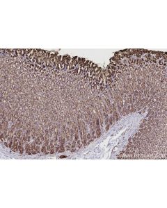 IHC easy ® URG4 Ready-To-Use IHC Kit KHC2714 proteintech