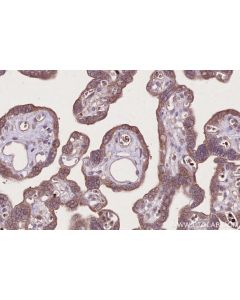 IHC easy ® WIPF2 Ready-To-Use IHC Kit KHC2728 proteintech