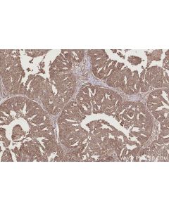 IHC easy ® USP9X Ready-To-Use IHC Kit KHC2770 proteintech