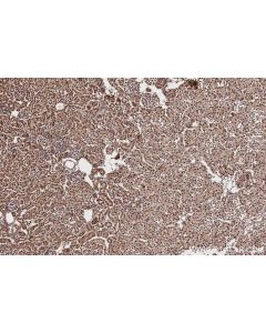 IHC easy ® TRNT1 Ready-To-Use IHC Kit KHC2818 proteintech