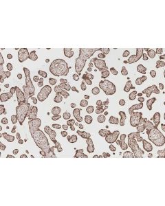 IHC easy ® VRK1 Ready-To-Use IHC Kit KHC2852 proteintech