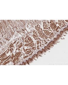 IHC easy ® UBAC1 Ready-To-Use IHC Kit KHC2862 proteintech