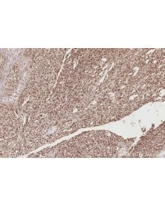 IHC easy ® WRAP53 Ready-To-Use IHC Kit KHC2870 proteintech