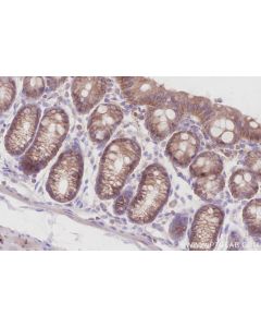 IHC easy ® ZDHHC5 Ready-To-Use IHC Kit KHC2891 proteintech
