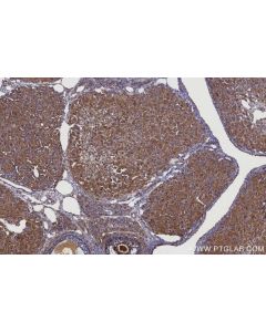 IHC easy ® WDCP Ready-To-Use IHC Kit KHC2921 proteintech