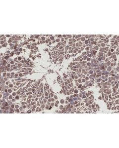 IHC easy ® USP29 Ready-To-Use IHC Kit KHC2929 proteintech