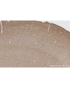 IHC easy ® VGLUT1 Ready-To-Use IHC Kit KHC2996 proteintech