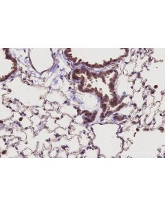 IHC easy ® UVRAG Ready-To-Use IHC Kit KHC2997 proteintech