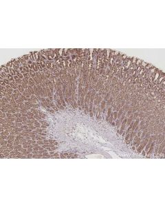 IHC easy ® VPS4A Ready-To-Use IHC Kit KHC3041 proteintech