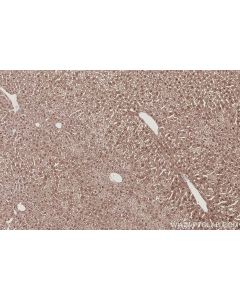 IHC easy ® USP24 Ready-To-Use IHC Kit KHC3047 proteintech