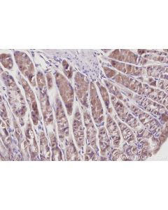 IHC easy ® VPS24 Ready-To-Use IHC Kit KHC3062 proteintech