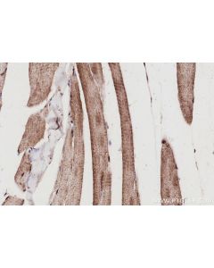 IHC easy ® UCHL5 Ready-To-Use IHC Kit KHC3078 proteintech