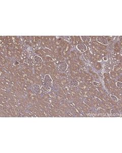 IHC easy ® USH1C Ready-To-Use IHC Kit KHC3095 proteintech