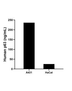 p63 Recombinant Matched Antibody Pair, PBS Only MP02275-1 proteintech