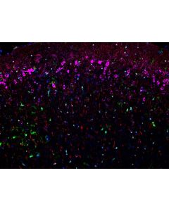 Four color TSA Detect Kit for Rabbit/Mouse Primary Antibody PK10032 proteintech