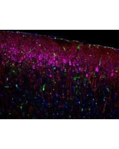 Four color TSA Detect Kit for Rabbit Primary Antibody PK10033 proteintech