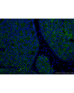 EMT Expanded Antibody Kit PK30015 proteintech