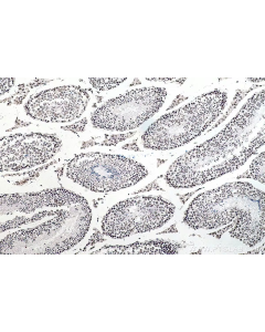 RNA Methylation Essentials Antibody Kit PK30016 proteintech