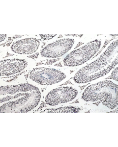 RNA Methylation Expanded Antibody Kit PK30017 proteintech