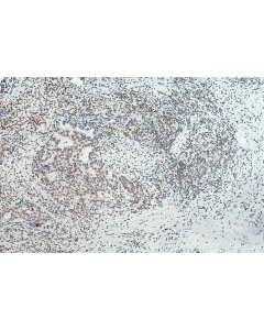 m6A Essentials Antibody Kit PK30018 proteintech