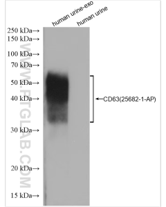 Exosome Essentials Antibody Kit PK30023 proteintech