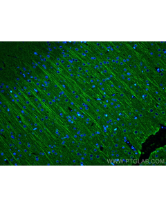 Neural Cell Markers Essentials Antibody Kit PK30026 proteintech