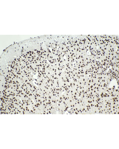 Multi-rAb® Polymer HRP-Goat Anti-Rabbit/Mouse Universal Recombinant Secondary Antibody (H+L) RGAU011 proteintech
