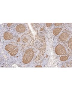 Multi-rAb® Enhanced Anti-Rabbit/Mouse Universal Secondary System Plus RGAU015 proteintech