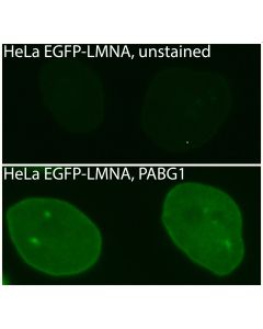 ChromoTek GFP Polyclonal antibody pabg1 proteintech