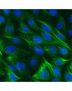 ChromoTek Vimentin-Label Atto488 vba488 proteintech