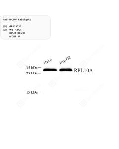Anti-RPL10A Rabbit pAb servicebio GB115036-100