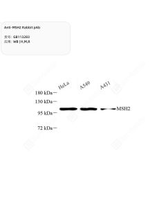 Anti-MSH2 Rabbit pAb servicebio GB113283-50