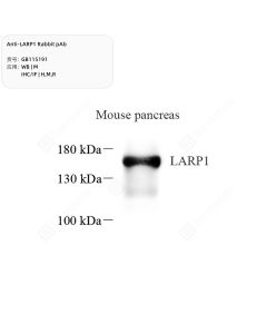 Anti-LARP1 Rabbit pAb servicebio GB115191-100