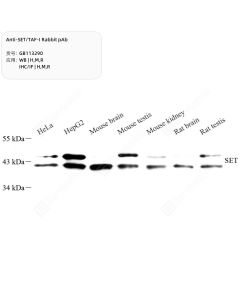 Anti-SET/TAF-I Rabbit pAb servicebio GB113290-100