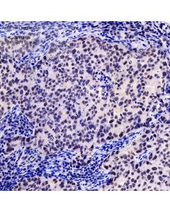 Anti-TFII I Rabbit pAb servicebio GB113138-100