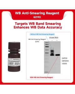 WB Anti-Smearing Reagent servicebio G2192-10ML