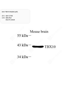 Anti-TBX10 Rabbit pAb servicebio GB112700-100