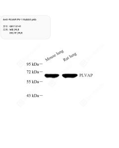 Anti-PLVAP/PV-1 Rabbit pAb servicebio GB113141-100