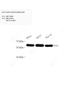 Anti-nmt55/p54nrb Rabbit pAb servicebio GB113000-100