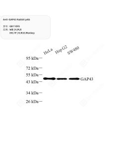 Anti-GAP43 Rabbit pAb servicebio GB11095-50