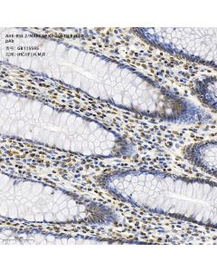 Anti-Rsk 2/MAPKAP Kinase 1b Rabbit pAb servicebio GB115595-100